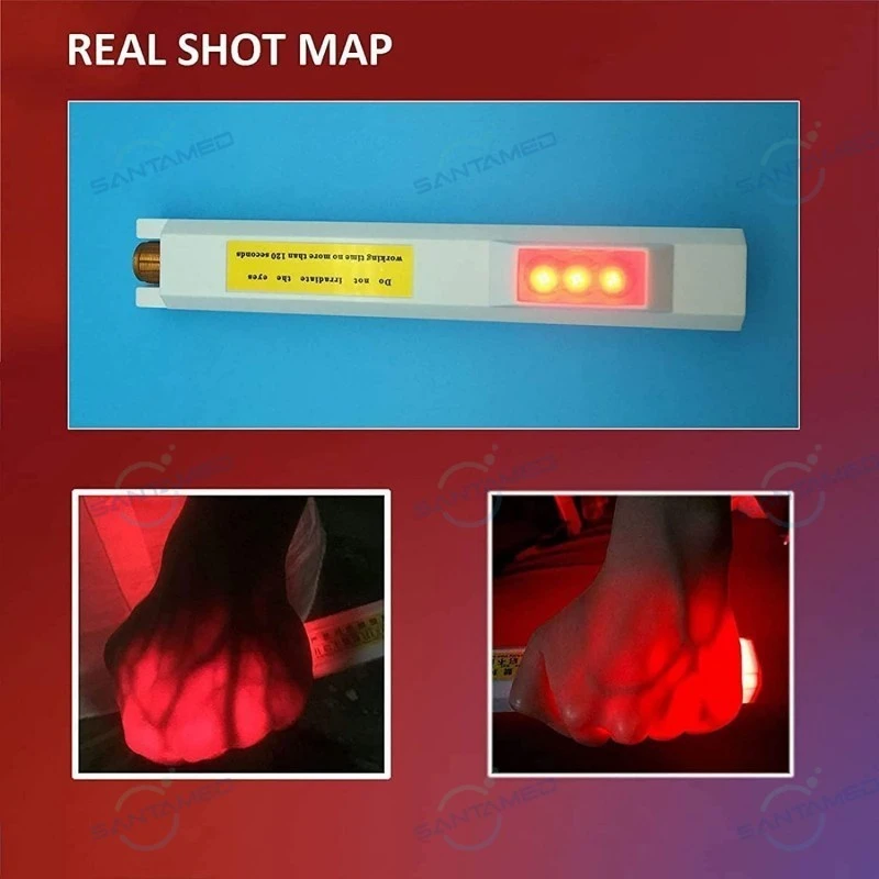 Best Cheap Vein Finder